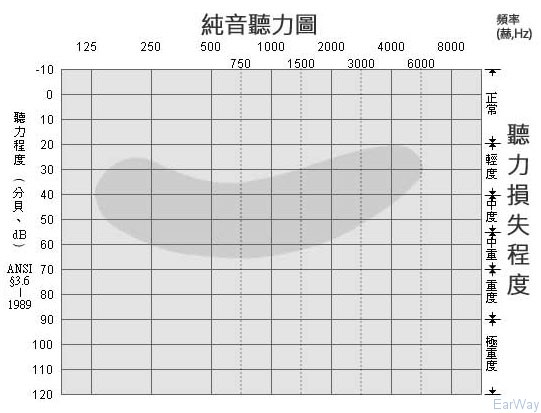 純音測試圖怎么看