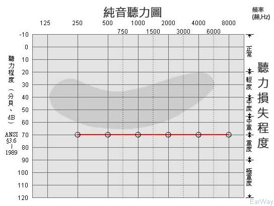 純音測試圖怎么看