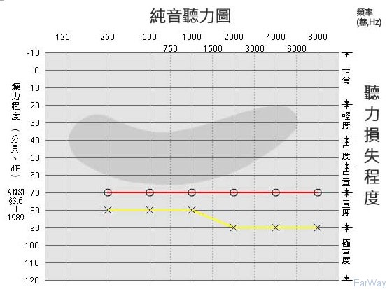 純音測試圖怎么看