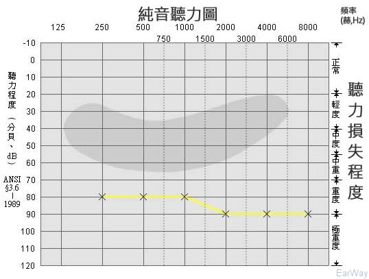 純音測試圖怎么看