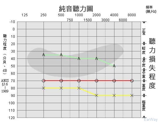 純音測試圖怎么看