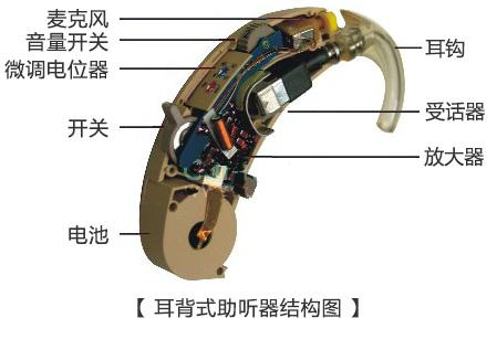 助聽器通氣孔-什么是助聽器通氣孔