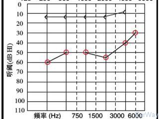 哪些因素影響純音測試