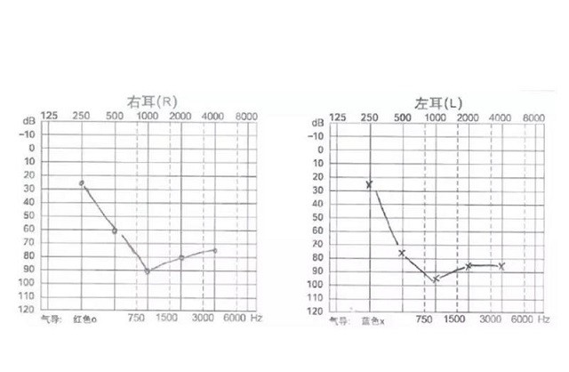 他的智能小聆聽，生活充滿無限可能